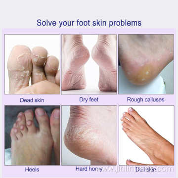 skin exfoliating calluses magic foot mask